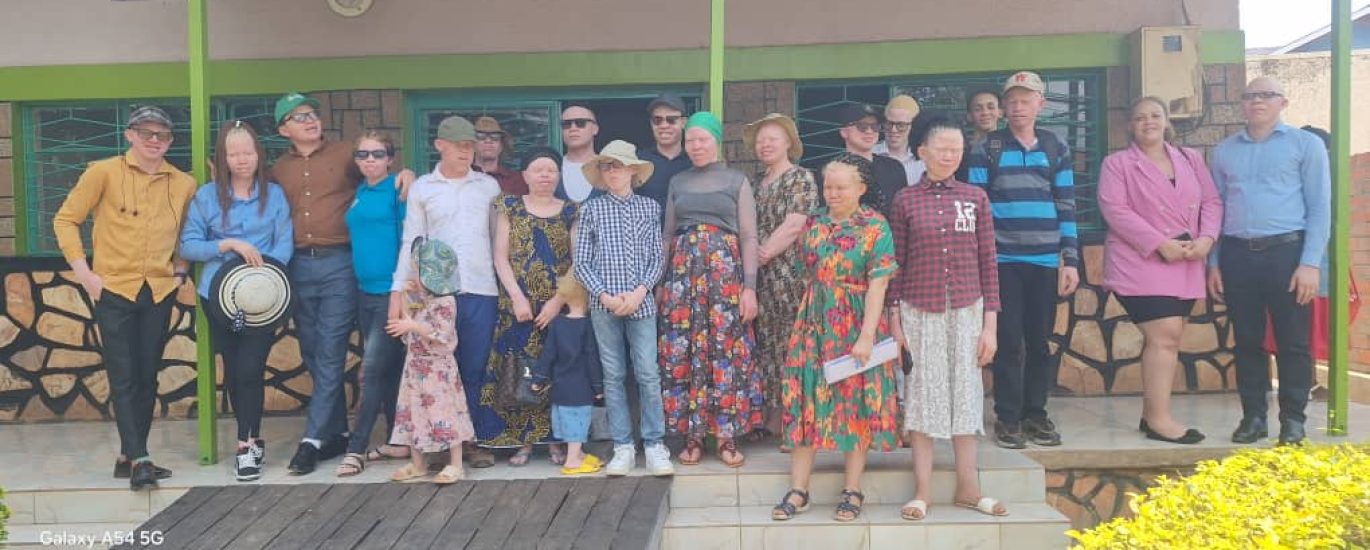 empowering persons with albinism in Kigali