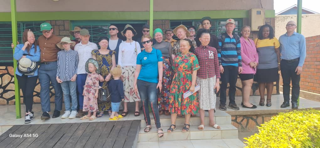 empowering persons with albinism in Kigali