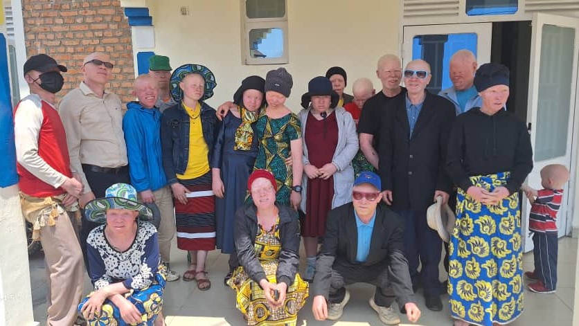 empowering persons with albinism in Rutsiro