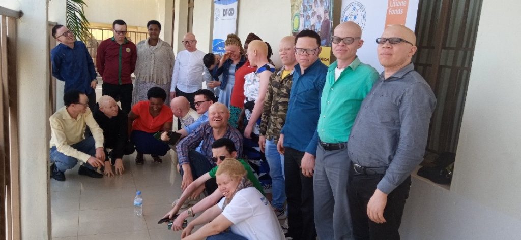 Understanding Persons With Albinism Myths vs. Facts